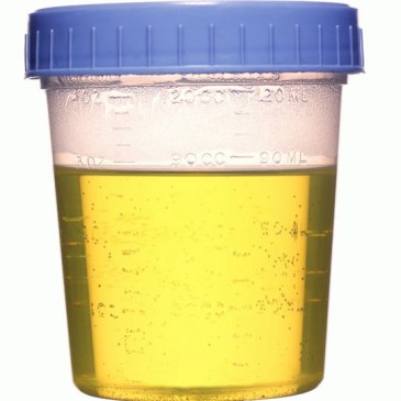 2012_2_16_urine_sample.jpg